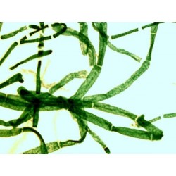 Mikroskopické preparáty - Podivuhodná stavba rostlinných buněk